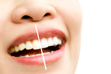 Какое отбеливание зубов самое безопасное и эффективное?